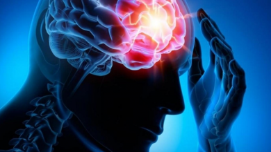 Epilepsi Nedir, Nedenleri ve Belirtileri Nelerdir?