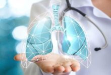 Bronşit Tedavisinde Doktor Kontrolünün Önemi